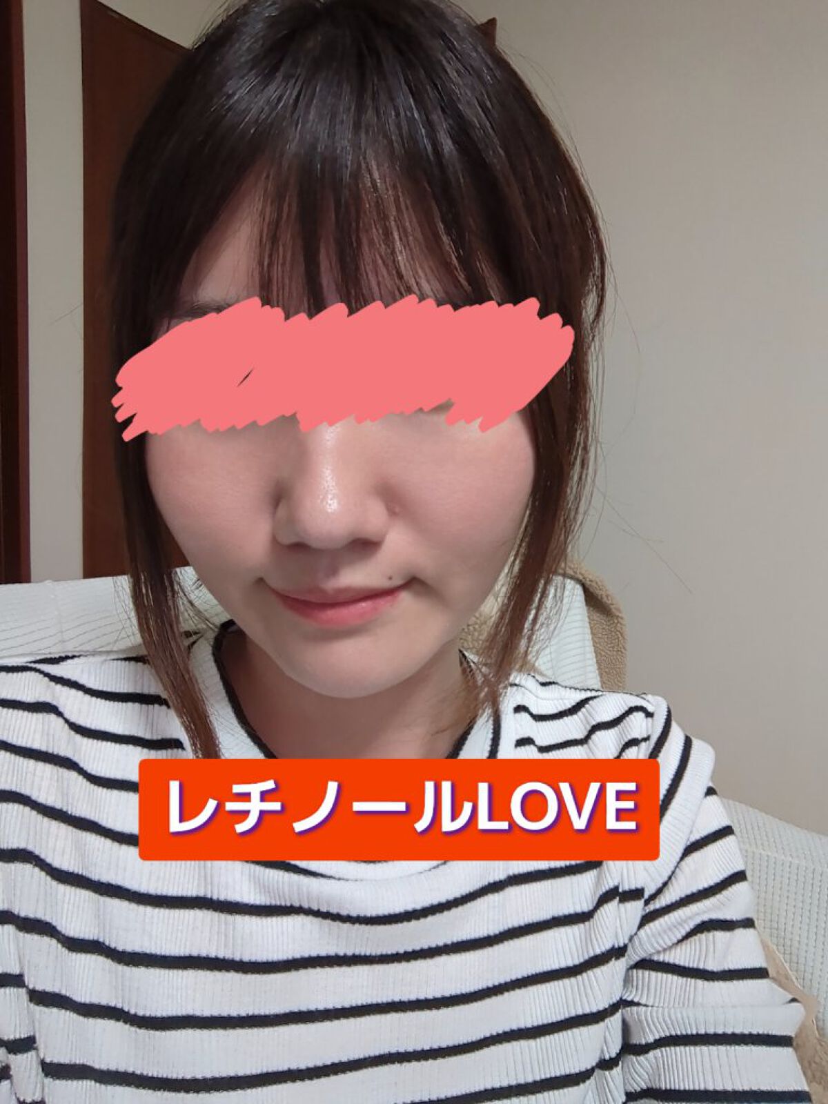 ユース ラディアンス ビタチノール セラム/primera/美容液を使ったクチコミ（2枚目）