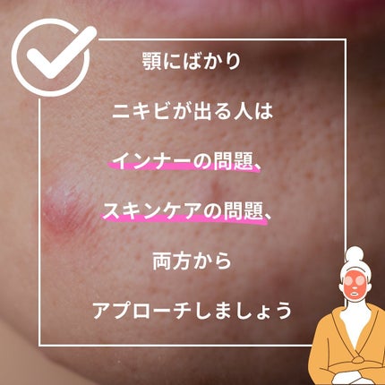 おゆみ|ニキビ・ニキビ跡ケア on LIPS 「@______ohyoume他の投稿【顎下のハリネズミを抹消し..」(6枚目)