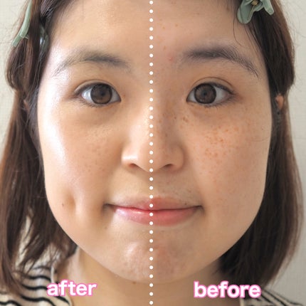 ヴェールヌーディ エッセンスパクトグロウ/AGE20’s/クリーム・エマルジョンファンデーションを使ったクチコミ(5枚目)