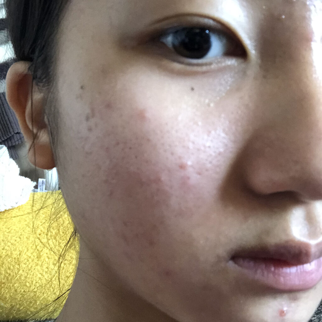 ディープモイスチャースプレー/キュレル/ミスト状化粧水を使ったクチコミ（2枚目）