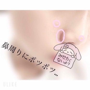 アンナザルベ・エース(医薬品)/エスエス製薬/その他を使ったクチコミ（2枚目）