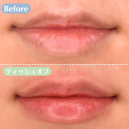 DOTOM LipPlus/keybo/リップバームを使ったクチコミ(9枚目)