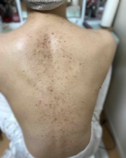 いつかの石けん/水橋保寿堂製薬/洗顔石鹸を使ったクチコミ(2枚目)