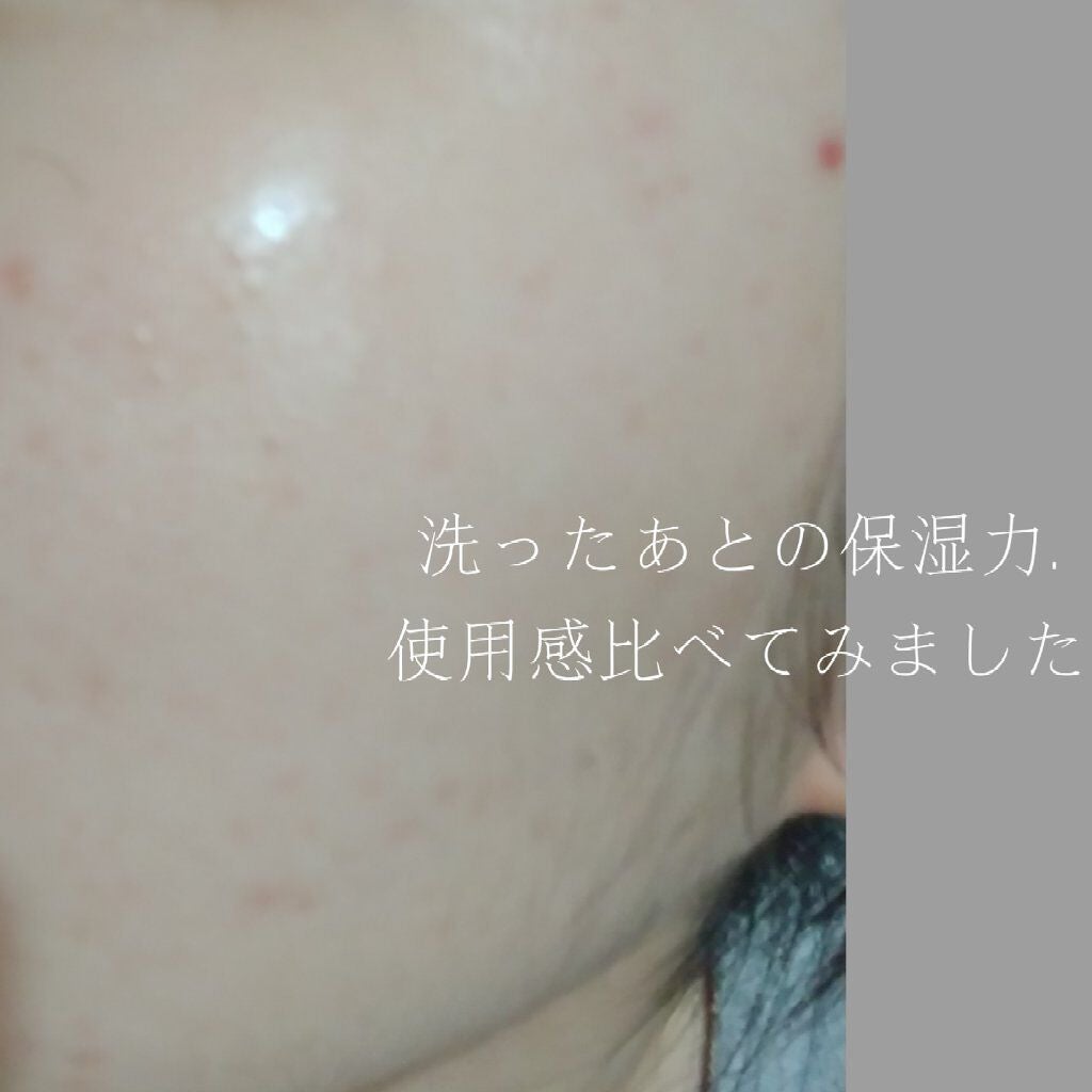 ハトムギ化粧水(ナチュリエ スキンコンディショナー R )/ナチュリエ/化粧水を使ったクチコミ(1枚目)