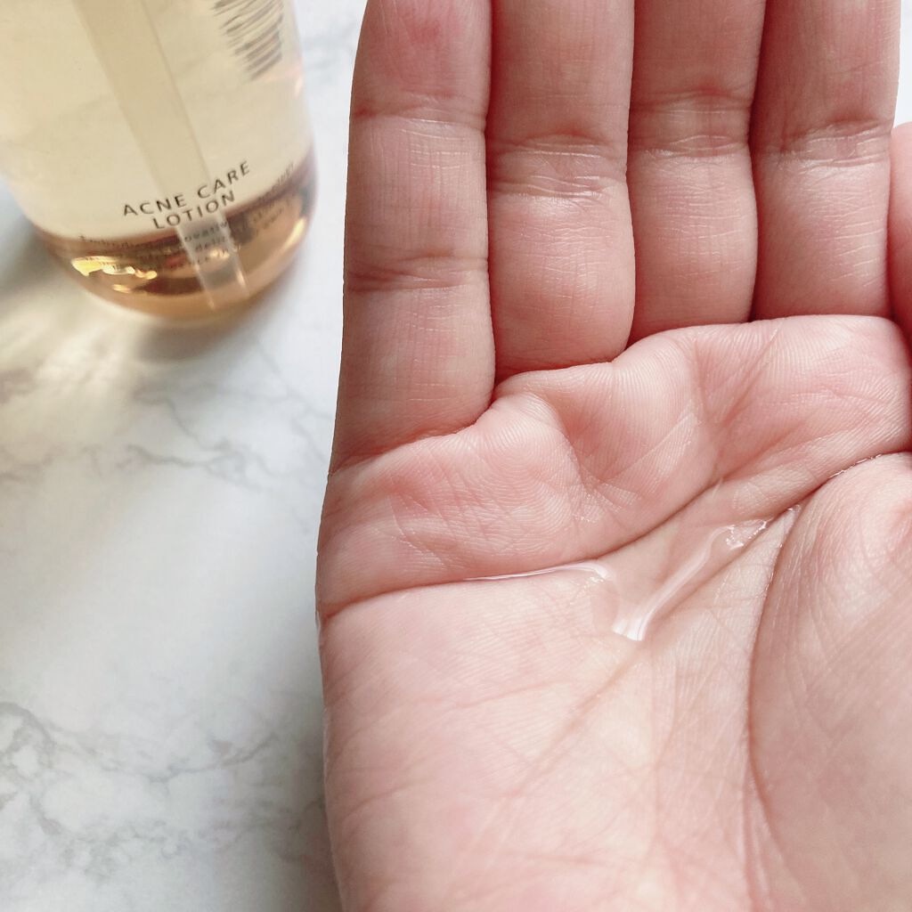 アクネケア ローション MB/d プログラム/化粧水を使ったクチコミ(2枚目)