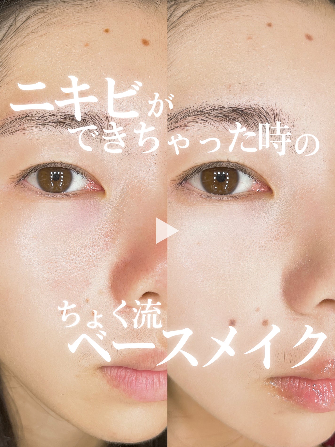 ãã©ããã£ãã¯ã¹ãã³ã»ã³ãµãŒããŒã¹ NEO/ããã¢ãŒãžã¥/åç²§äžå°ã䜿ã£ãã¯ãã³ãïŒ1æç®ïŒ