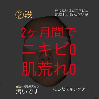 ベピオゲル/マルホ株式会社/その他を使ったクチコミ（1枚目）