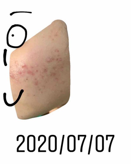 ハトムギ保湿ジェル(ナチュリエ スキンコンディショニングジェル)/ナチュリエ/美容液を使ったクチコミ(4枚目)