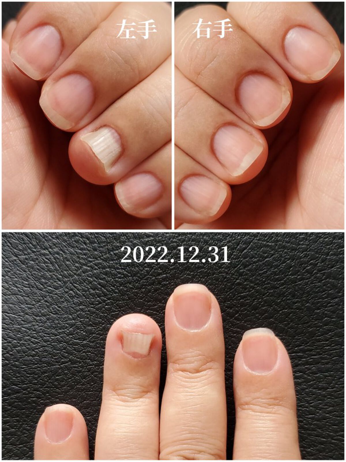 ドロップリペアセラム/ネイルネイル/ネイルオイル・トリートメントを使ったクチコミ（2枚目）