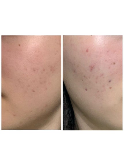 を使ったクチコミ(2枚目)