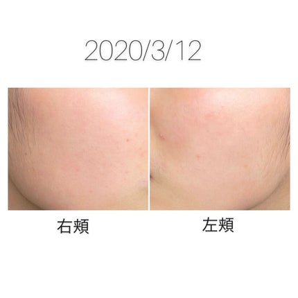 ハトムギ保湿ジェル(ナチュリエ スキンコンディショニングジェル)/ナチュリエ/美容液を使ったクチコミ(4枚目)