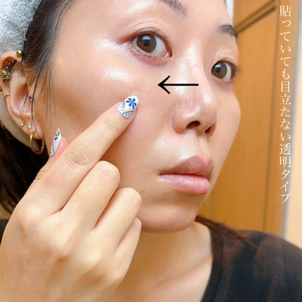 SPOT PATCH ロールタイプ/Shupong/にきびパッチを使ったクチコミ(4枚目)