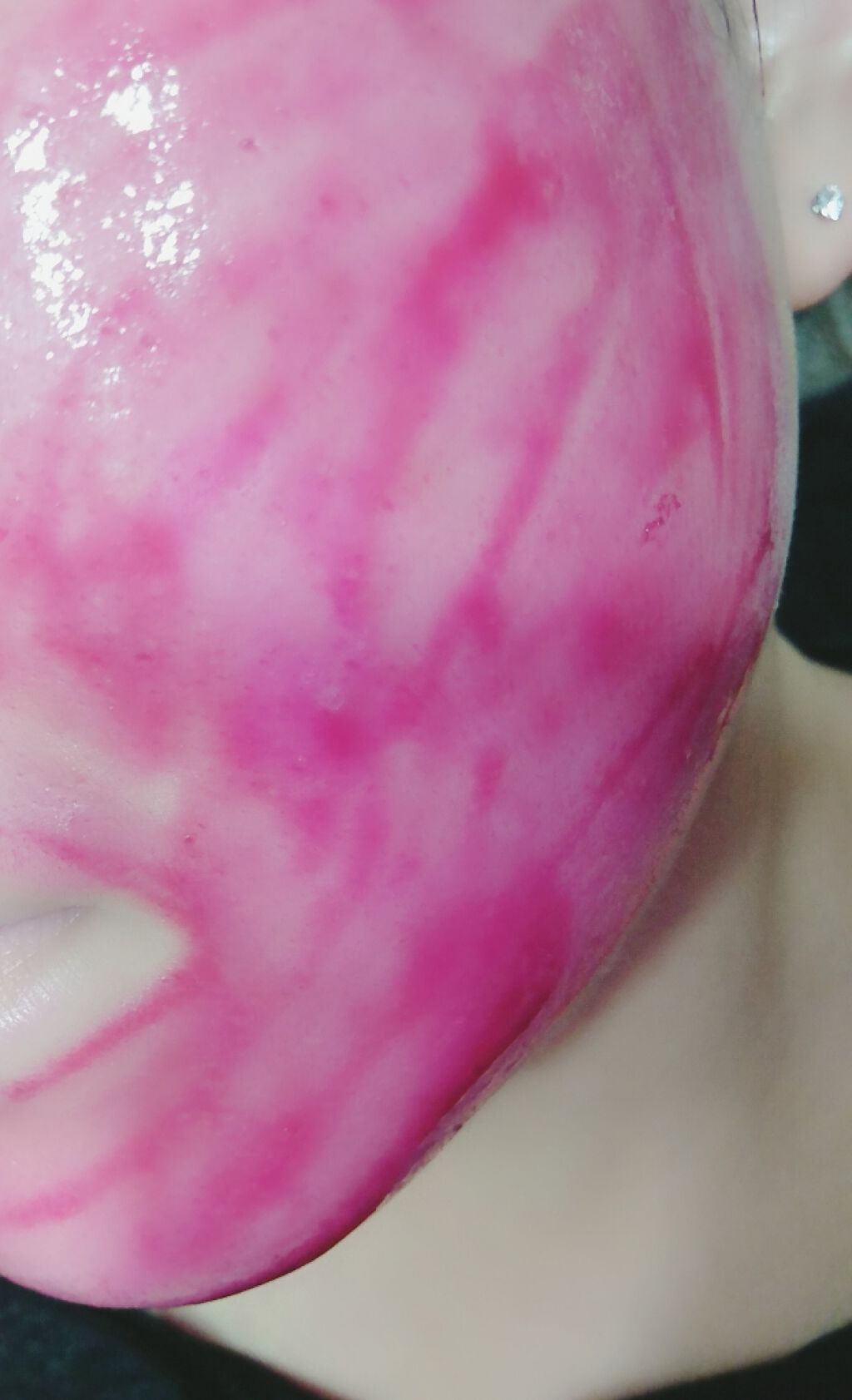 AHA 30% + BHA 2% Peeling Solution/The Ordinary/ピーリングを使ったクチコミ(2枚目)