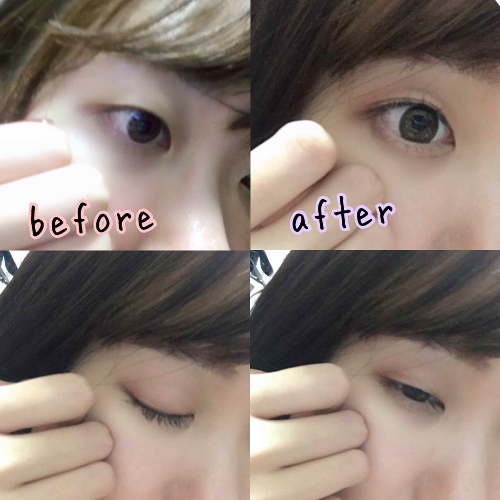 ハイブリッドフィルム/アイトーク/二重まぶた用アイテムを使ったクチコミ(3枚目)