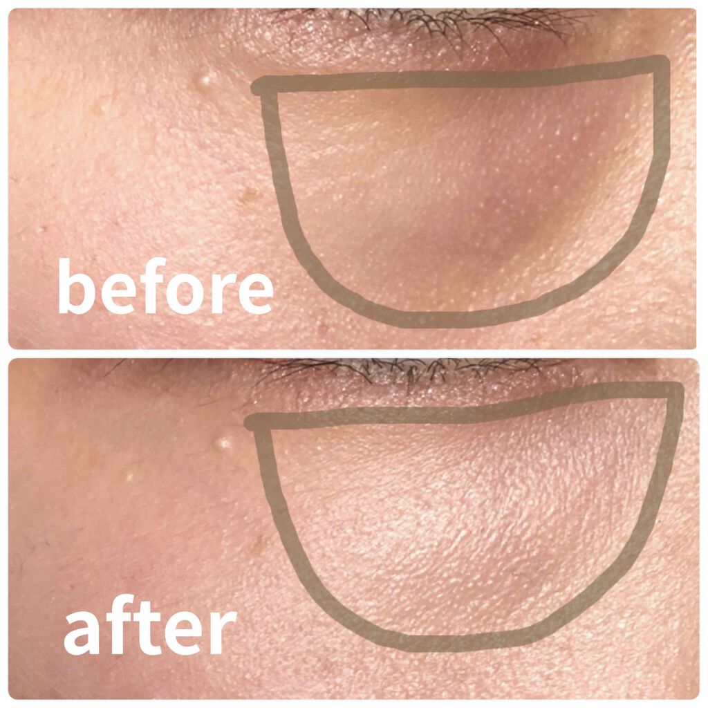 シークレットコンシーラー/ローラ メルシエ/クリームコンシーラーを使ったクチコミ（2枚目）