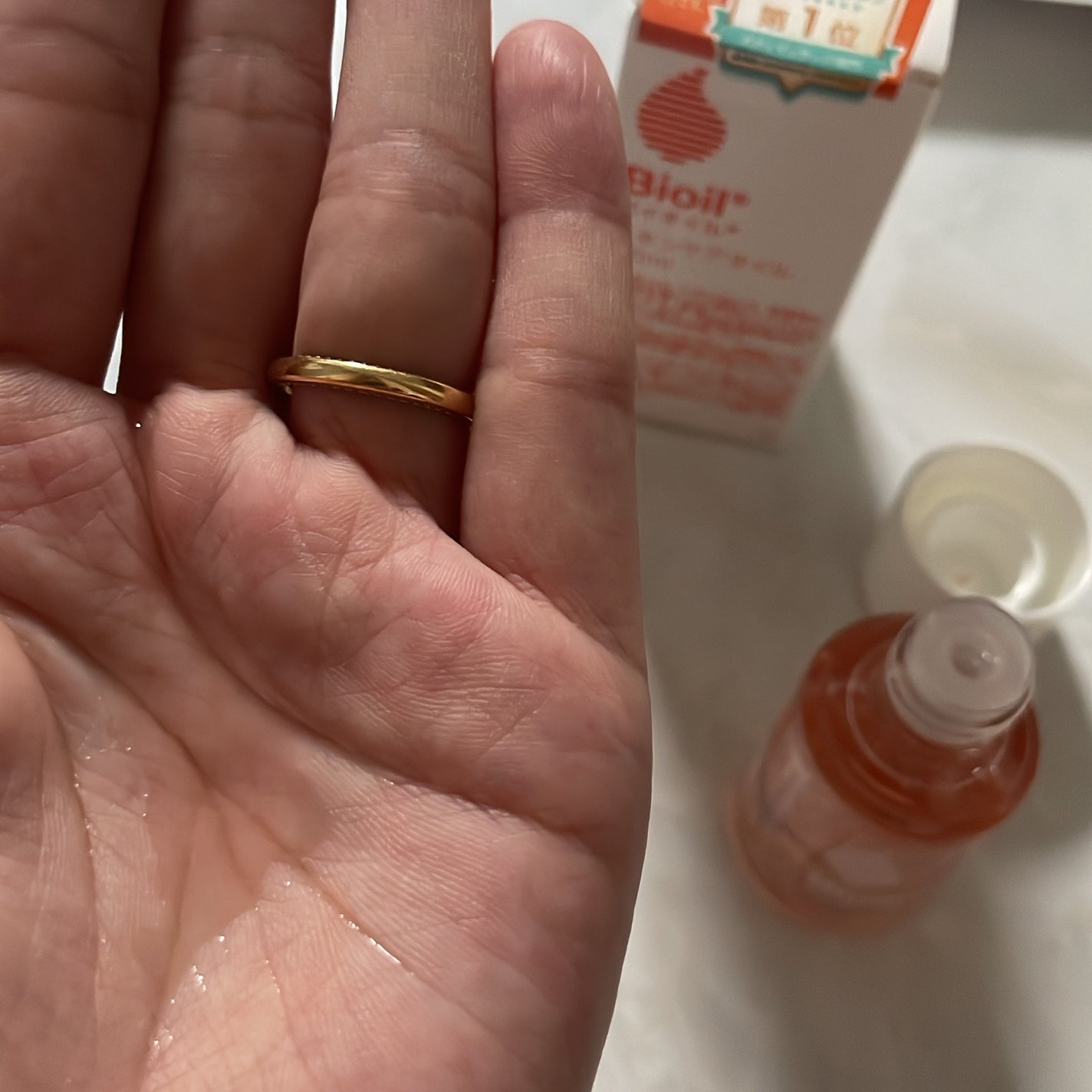 バイオイル/バイオイル/フェイスオイルを使ったクチコミ(5枚目)