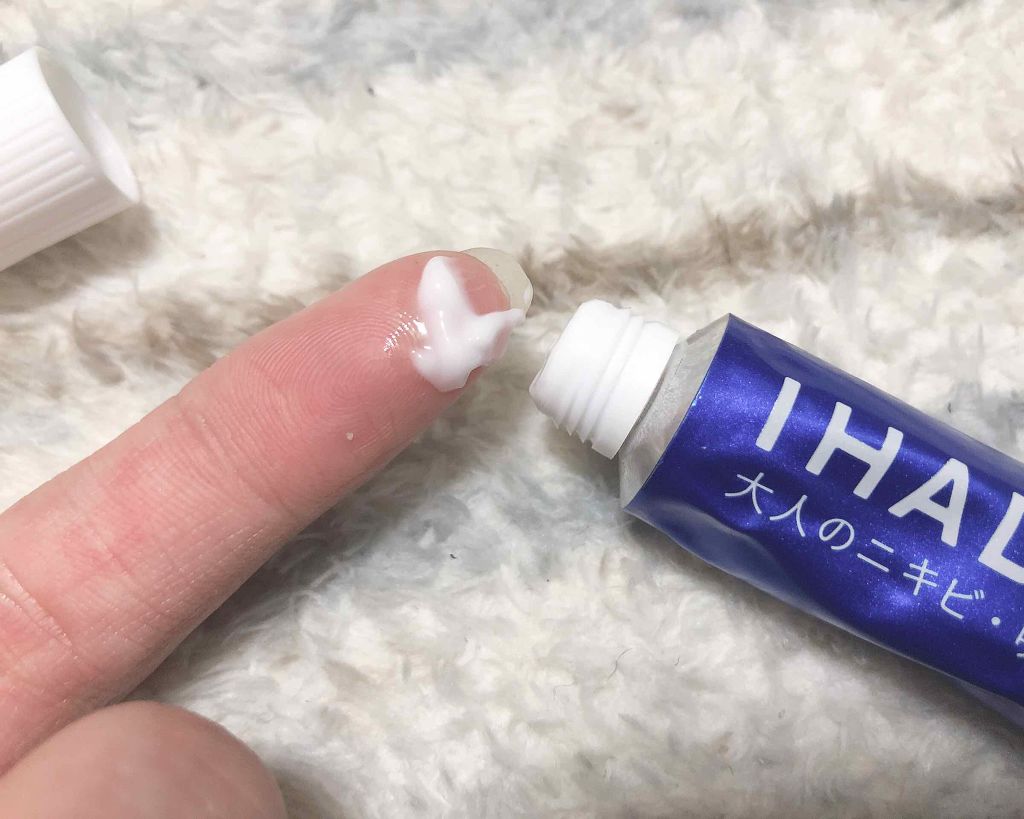 アクネキュアクリーム(医薬品)/IHADA/その他を使ったクチコミ(2枚目)