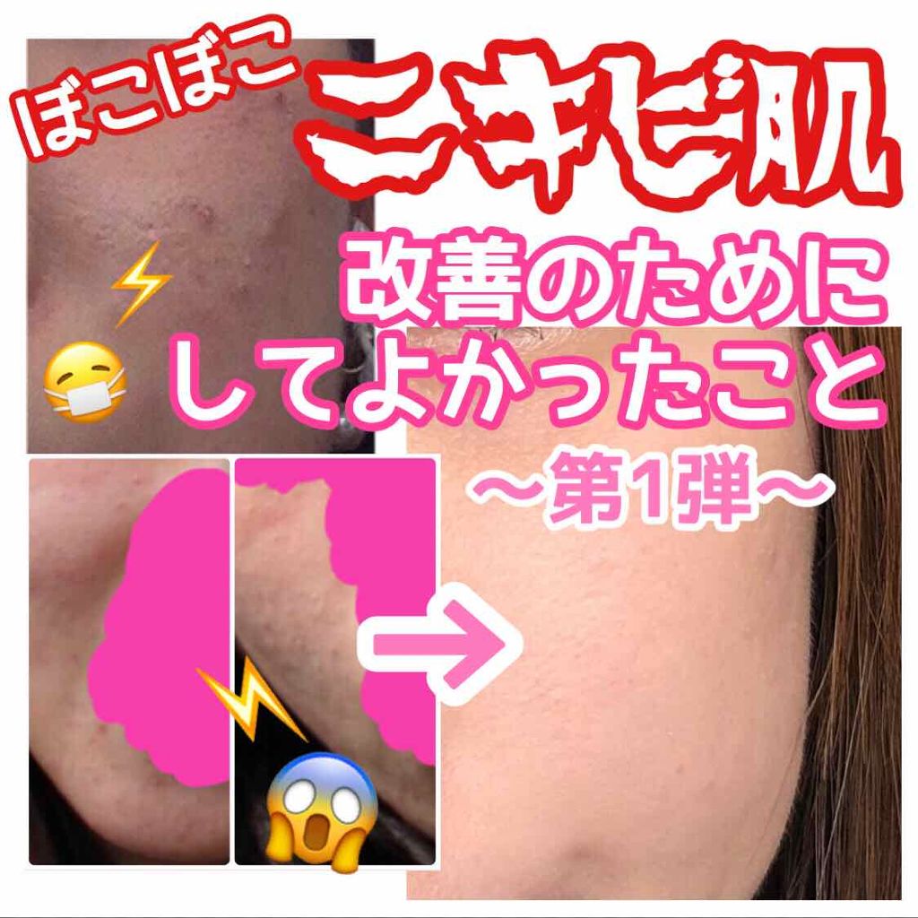 薬用3ステップセット30日サイズ/プロアクティブ/トライアルキットを使ったクチコミ（1枚目）