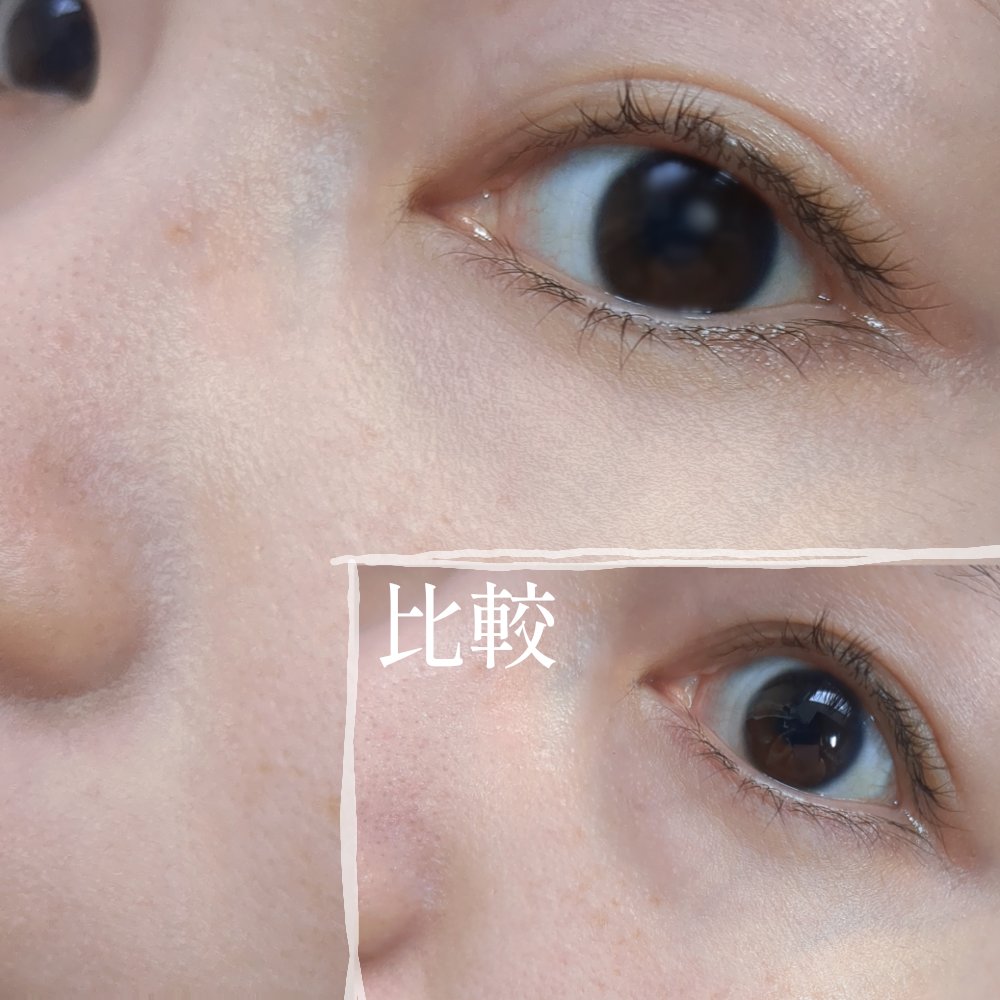 カラーミキシングコンシーラー 04 レッドベージュ/キャンメイク/パレットコンシーラーを使ったクチコミ（3枚目）