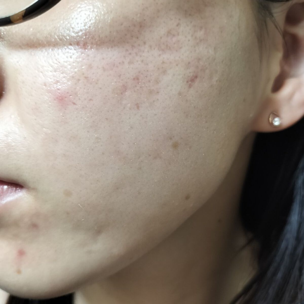 ビオオイル アルガンオイル/Melvita/フェイスオイルを使ったクチコミ（2枚目）