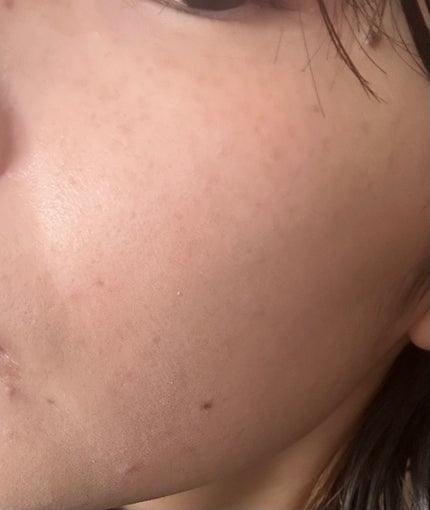 ヴィーガンナチュラルカバースティックファンデーション/DERMASHARE/その他ファンデーションを使ったクチコミ(4枚目)