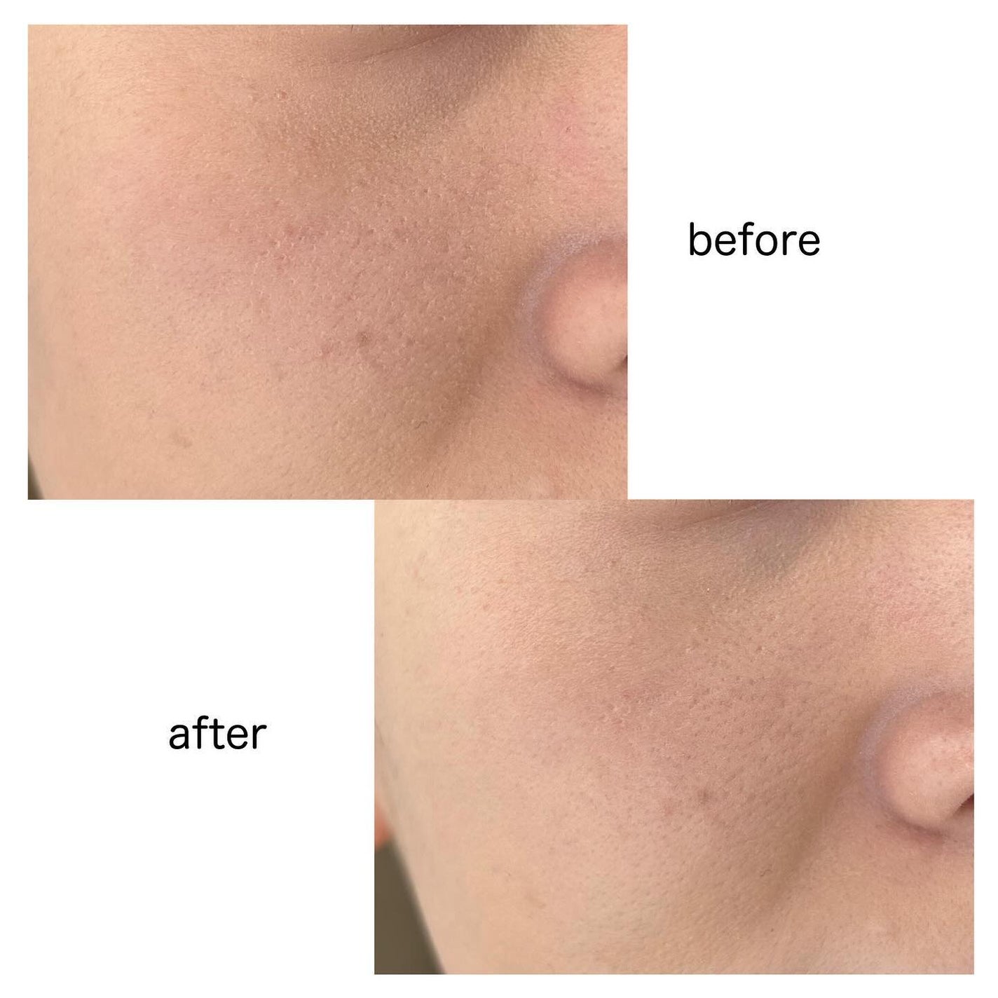 ライトリフレクティング プリズマティックパウダー/NARS/プレストパウダーを使ったクチコミ(8枚目)