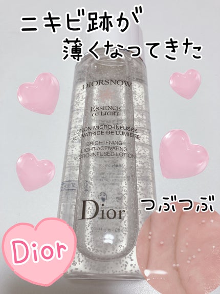 スノー ライト エッセンス ローション (薬用化粧水) (医薬部外品)/Dior/化粧水を使ったクチコミ(1枚目)