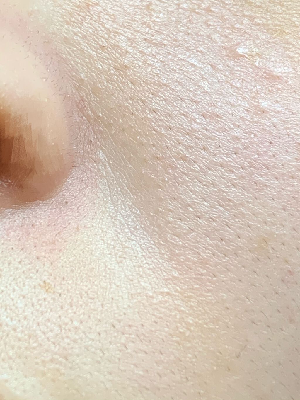 みったんちゃん on LIPS 「【助けて】毛穴?、剃れないレベルの細かな産毛(毛穴汚れに見える..」(2枚目)