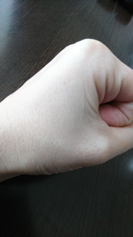 アルビオン パウダレスト/ALBION/パウダーファンデーションを使ったクチコミ(1枚目)