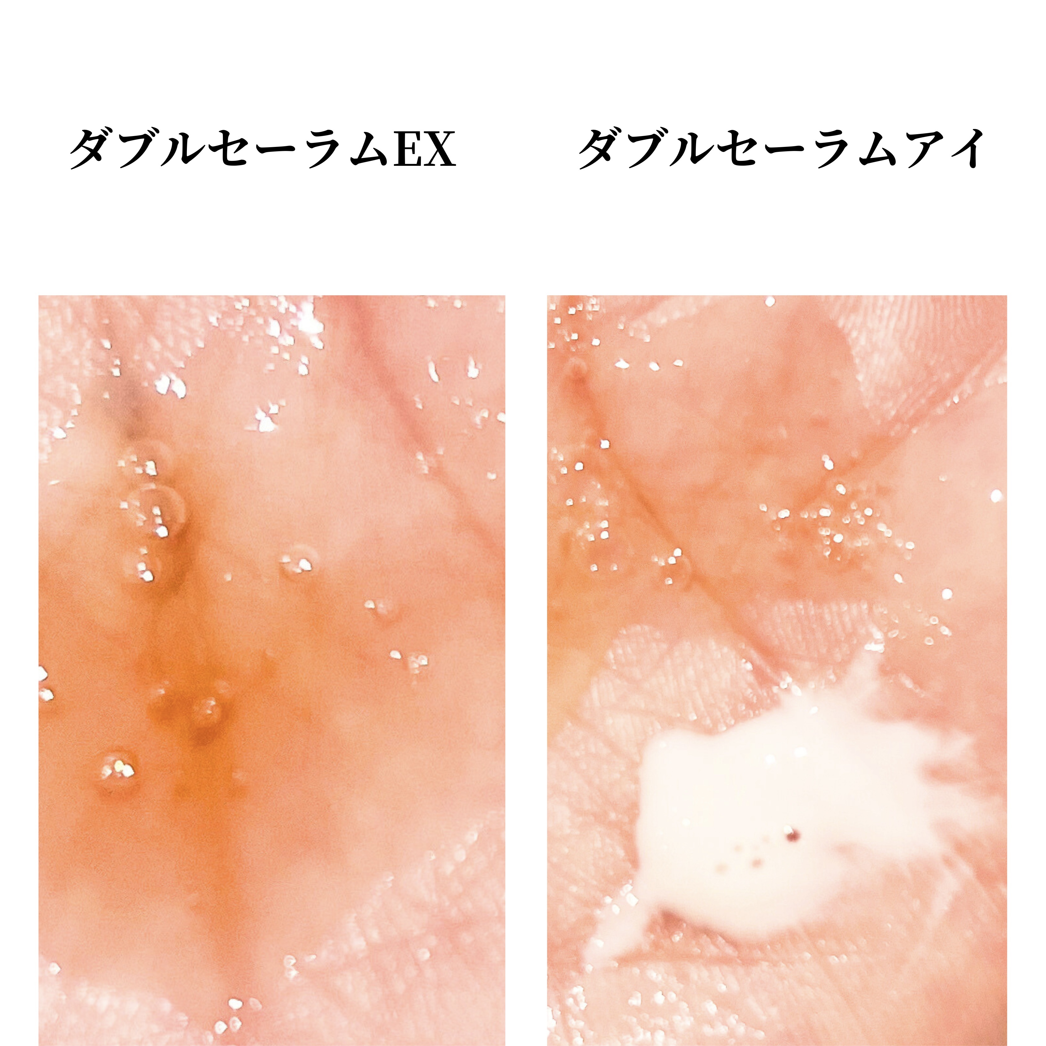 ダブル セーラム EX/CLARINS/美容液を使ったクチコミ（2枚目）