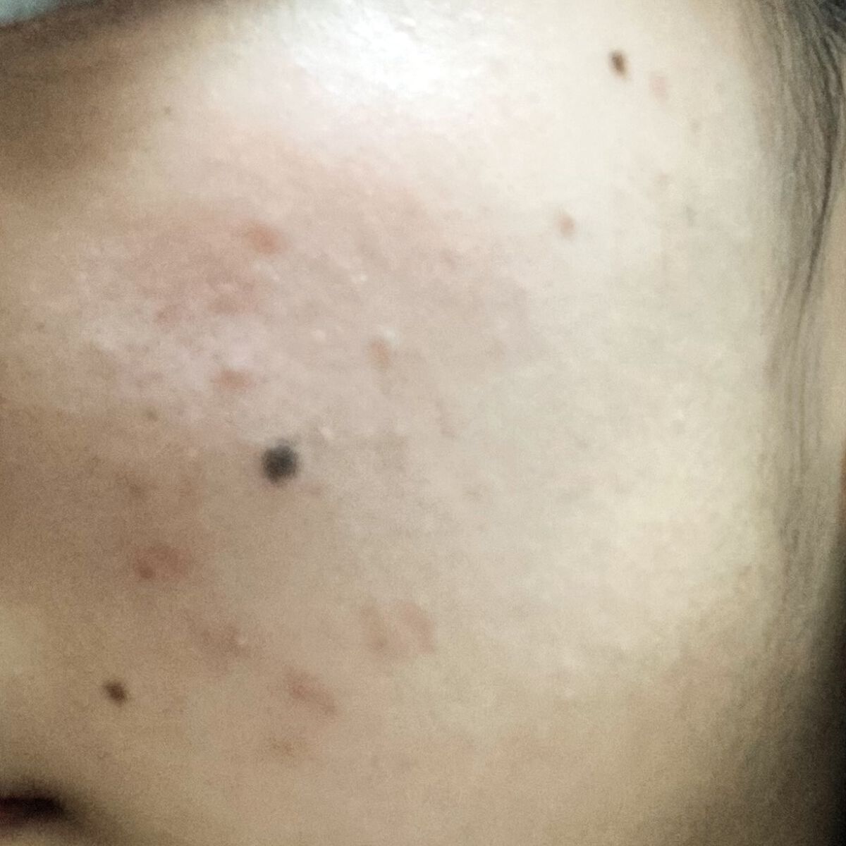 RXザ・レチノール0.1クリーム/COSRX/フェイスクリームを使ったクチコミ（2枚目）