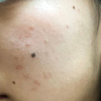 RXザ・レチノール0.1クリーム/COSRX/フェイスクリームを使ったクチコミ(2枚目)