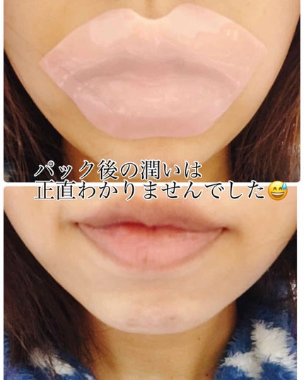 リップパック /CHOOSY/リップマスクを使ったクチコミ(3枚目)