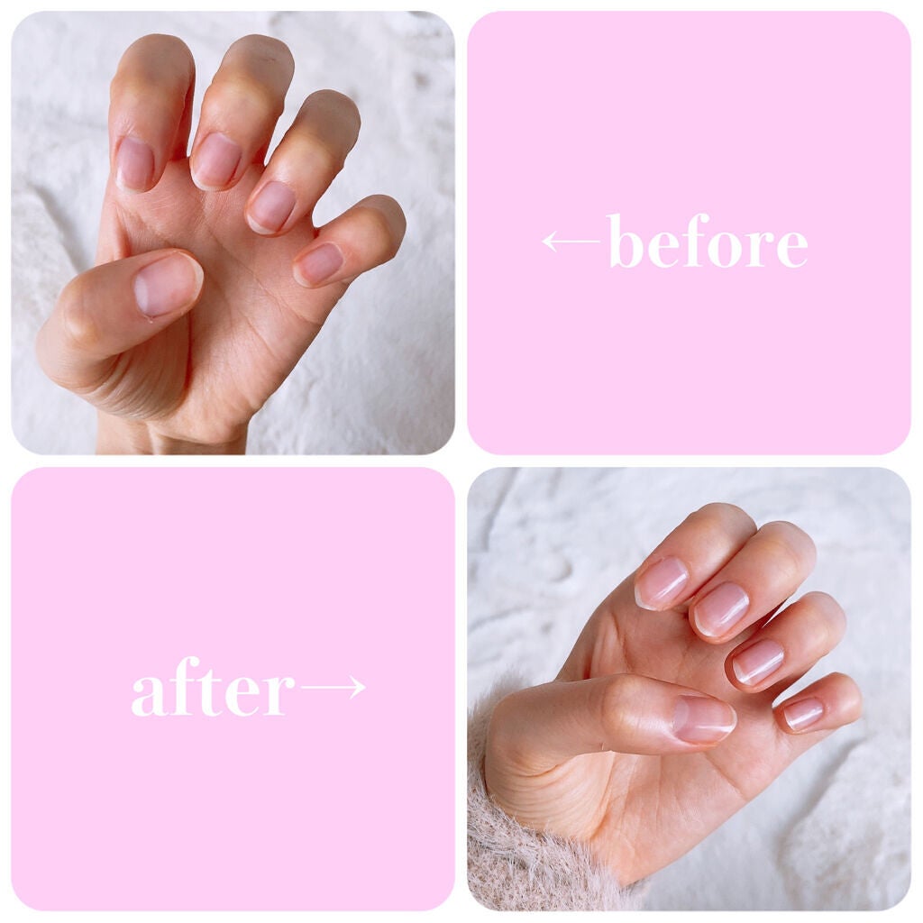 ディーアップファンデーション/D-UP/ネイルベースコートを使ったクチコミ(2枚目)