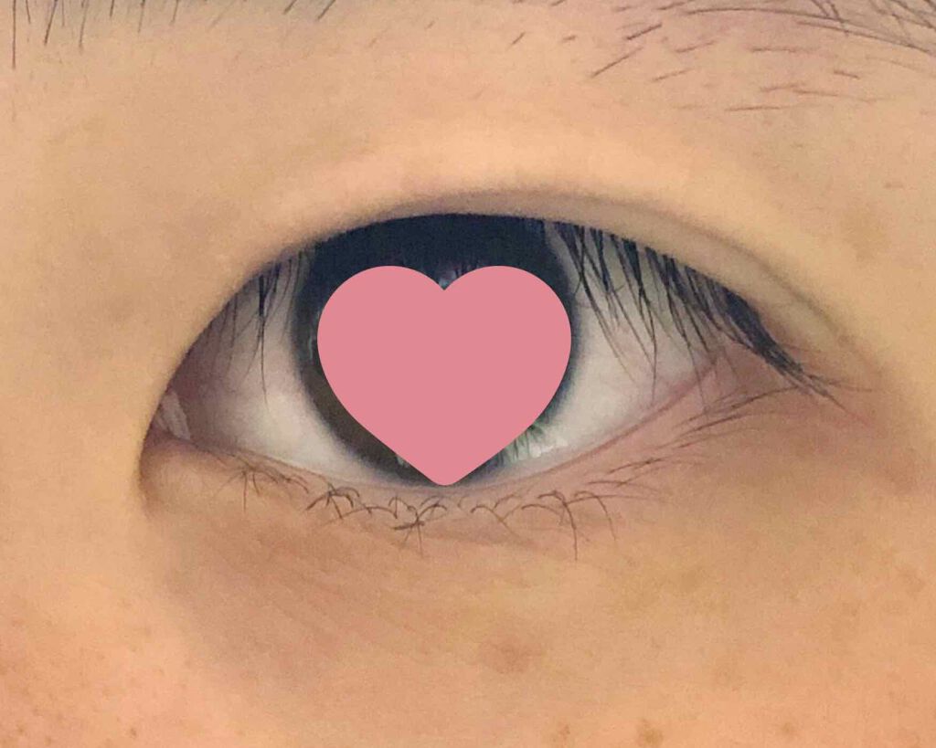 アイビューティー フィクサー WP/アストレア ヴィルゴ/二重まぶた用アイテムを使ったクチコミ（2枚目）