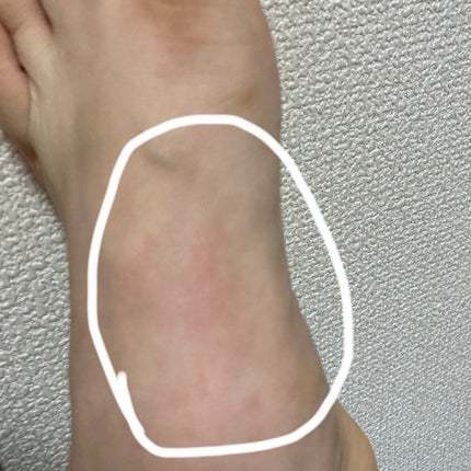 おにぎり on LIPS 「今回はずっと気になっていたフットパックやってみました!!足の袋..」(4枚目)