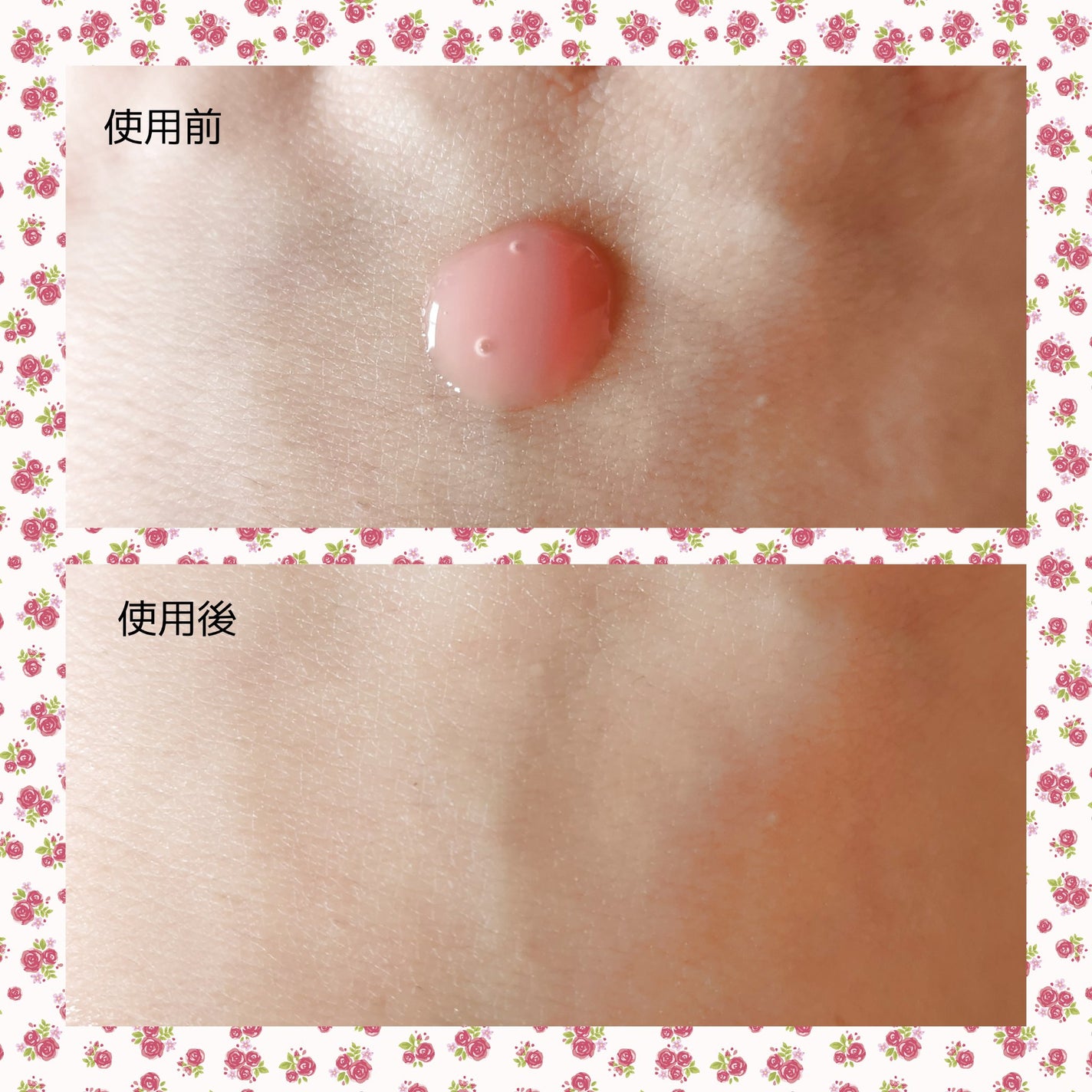 PDRNピンクアンプル PDRN 10,000ppm配合/MEDICUBE/美容液を使ったクチコミ(3枚目)