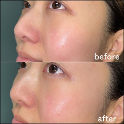 PHセンシティブクリームミスト/SAM'U/ミスト状化粧水を使ったクチコミ(6枚目)