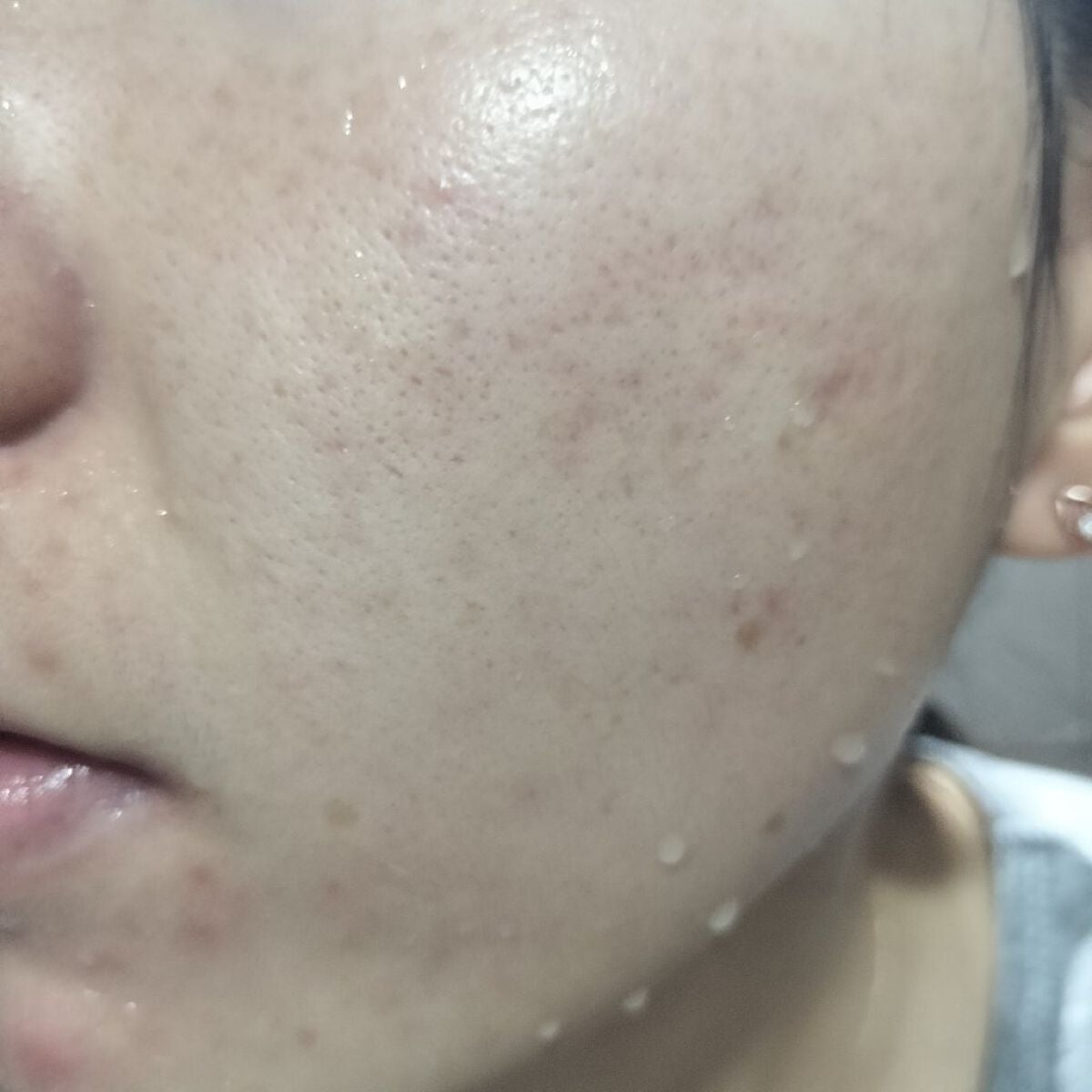 miina@汚肌工事録⚠️ on LIPS 「✍11/10の#汚肌工事録いつも優しく見守ってくれるみなさん、..」(2枚目)