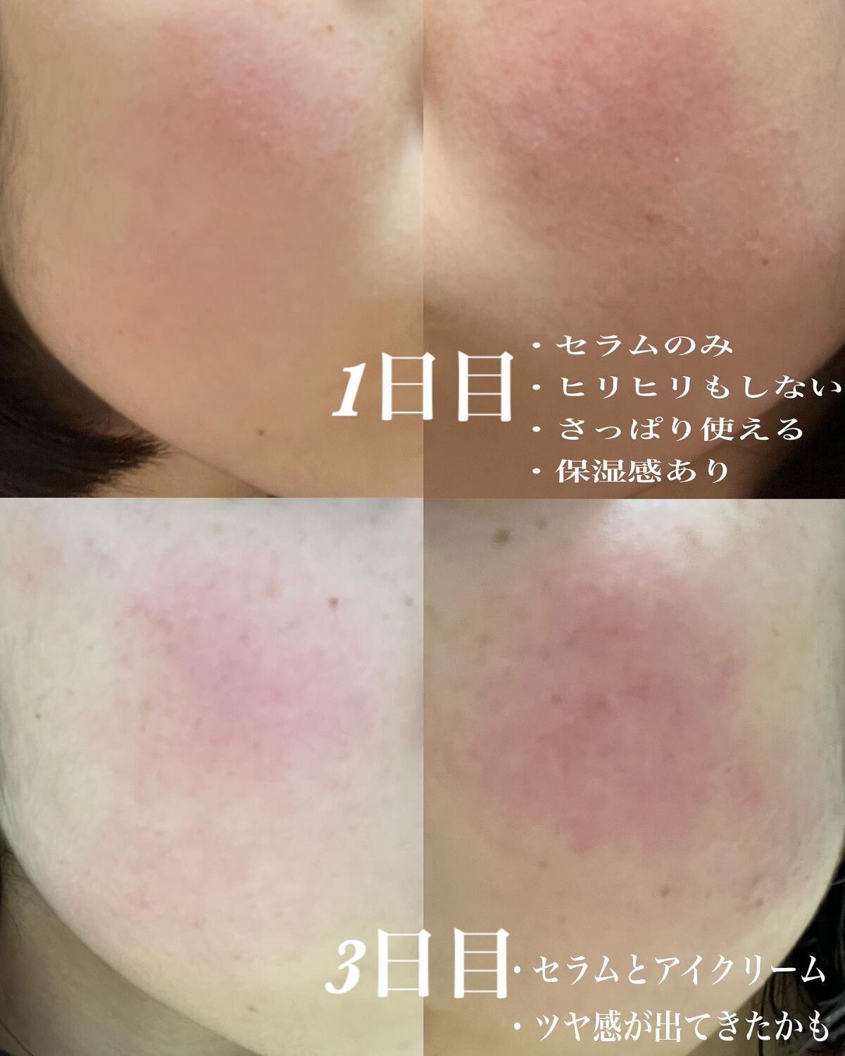 レチノールインテンシブ アドバンスドトリプルアクションアイクリーム/SOME BY MI/アイケア・アイクリームを使ったクチコミ（3枚目）