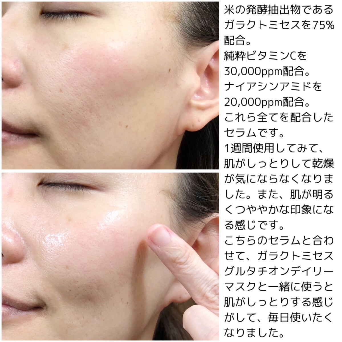 ガラクトミセスピュアビタミンCグローセラム/SOME BY MI/美容液を使ったクチコミ(5枚目)