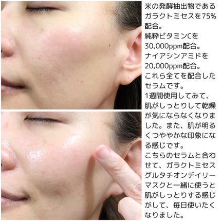 ガラクトミセスピュアビタミンCグローセラム/SOME BY MI/美容液を使ったクチコミ(5枚目)