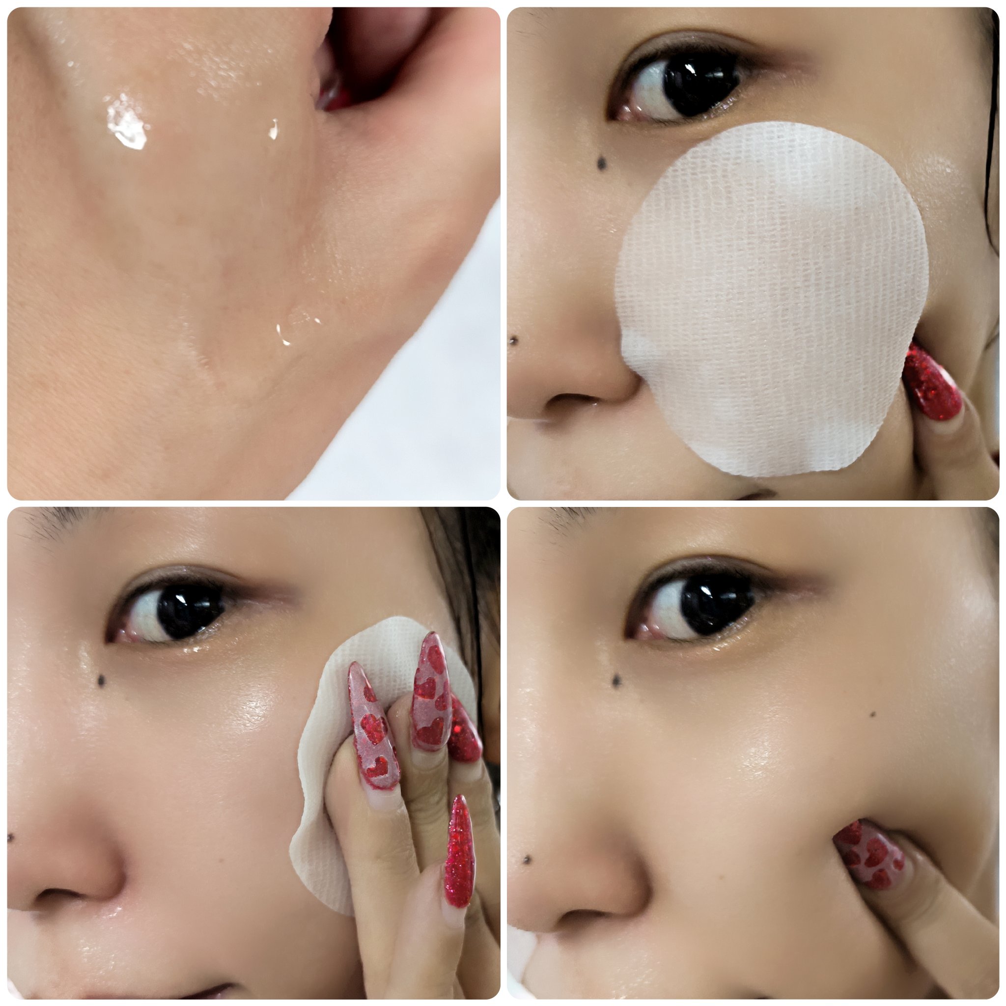 ブレミッシュケアパッド/ISOI/トナーパッドを使ったクチコミ（3枚目）