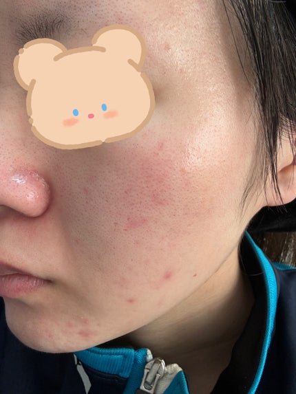 白潤 薬用美白化粧水(しっとりタイプ)/肌ラボ/化粧水を使ったクチコミ(2枚目)