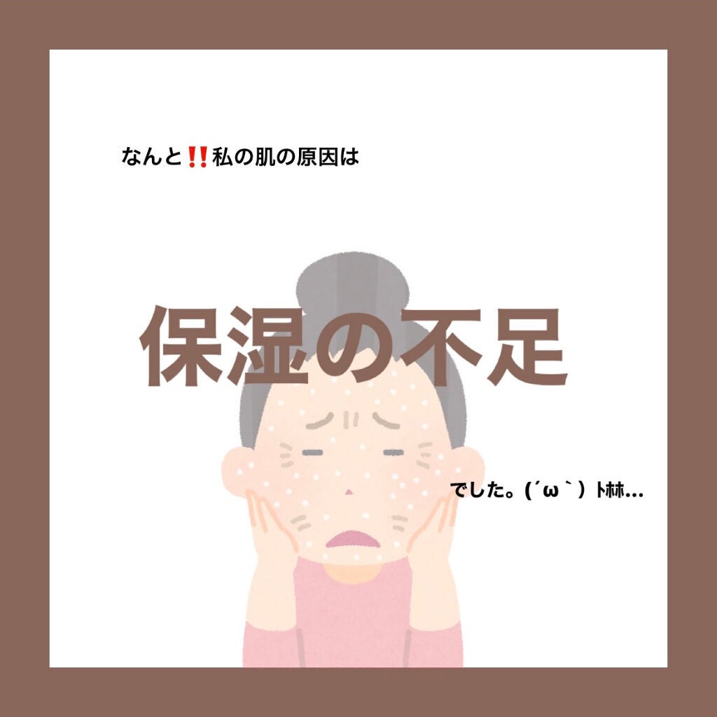 シミ・ソバカス予防ケア 乳液/キュレル/乳液を使ったクチコミ(4枚目)
