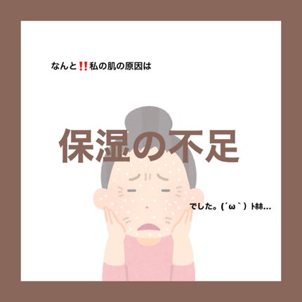 シミ・ソバカス予防ケア 乳液/キュレル/乳液を使ったクチコミ(4枚目)