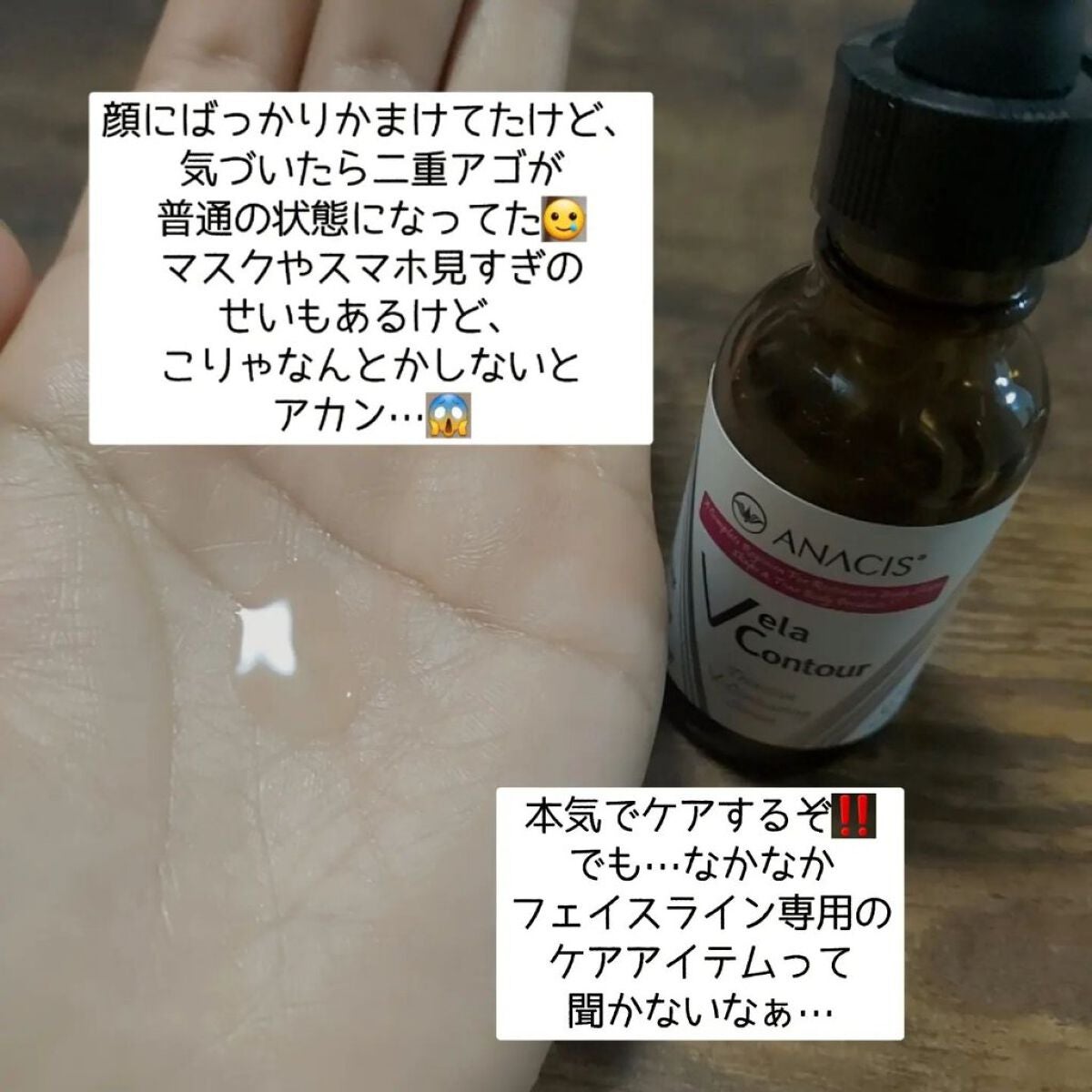 4DリピールVパック/ANACIS/シートマスク・パックを使ったクチコミ(2枚目)