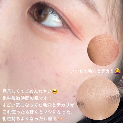 オイルコントロールカプセルエッセンス/celimax/美容液を使ったクチコミ(4枚目)