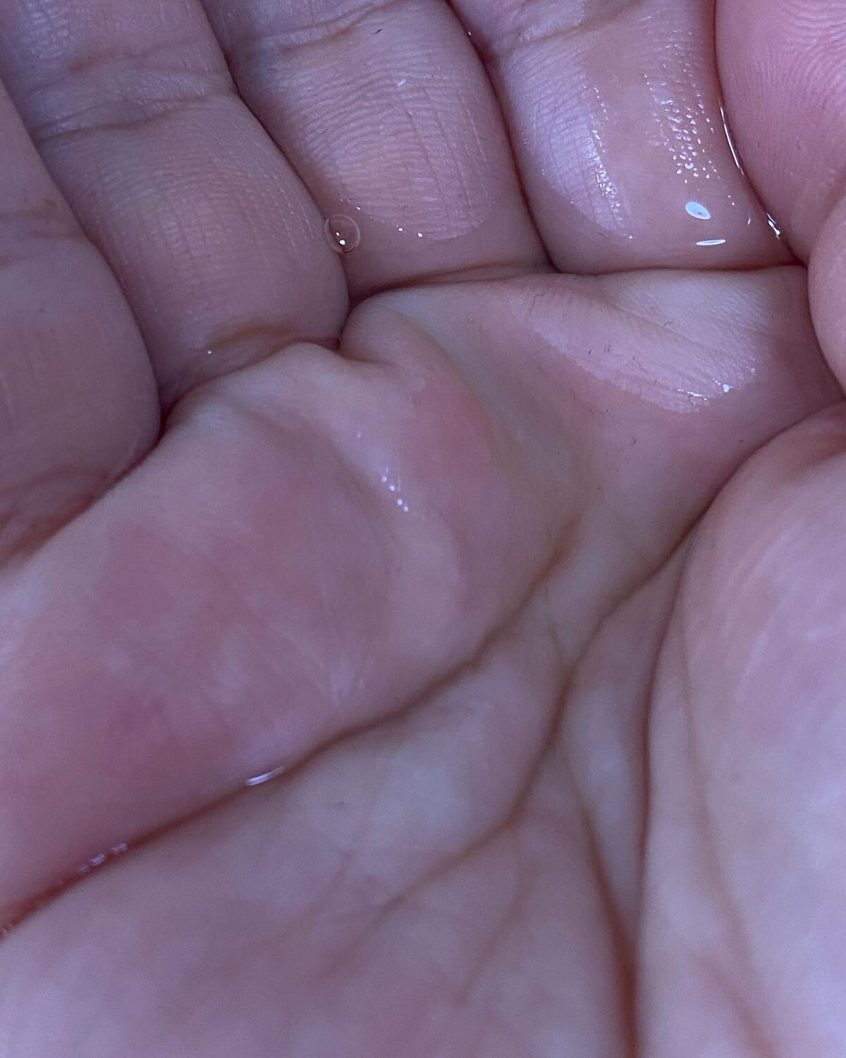 VC100ダブルリペアセラム/ドクターシーラボⓇ/美容液を使ったクチコミ(3枚目)