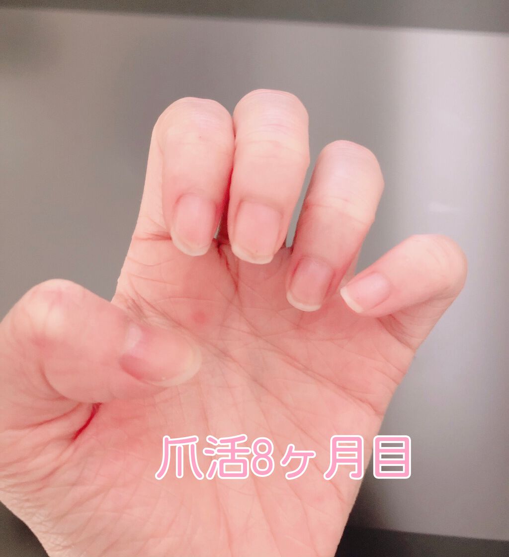 エテュセ クイックケアコート/ettusais/ネイルオイル・トリートメントを使ったクチコミ（2枚目）